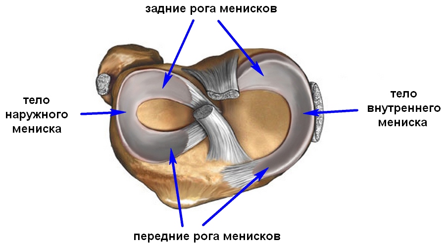 deteriorarea degenerativă a meniscului intern al articulației genunchiului