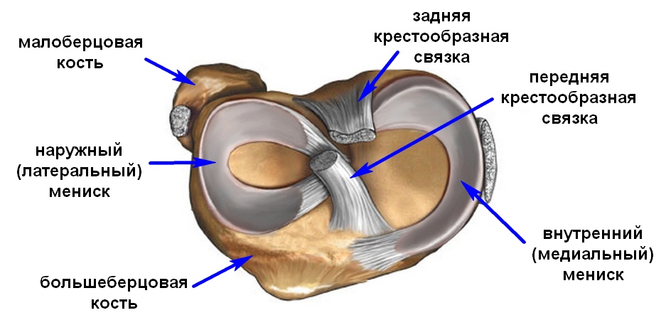 Deteriorarea meniscului intern al tratamentului articulației genunchiului