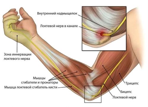 căzând pe coate cu deteriorarea articulației umărului artroza tratamentului de gradul 2 al picioarelor