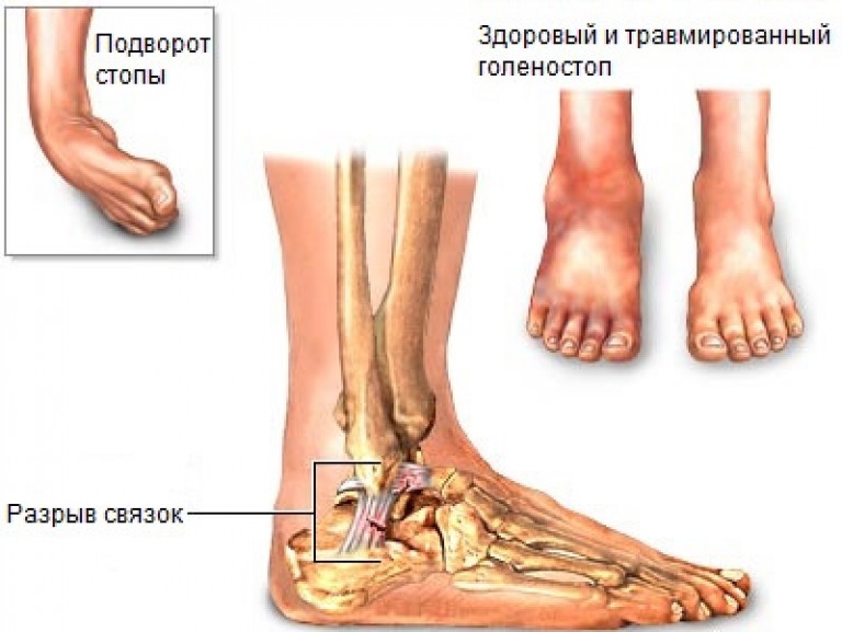 durere care crunching articulația genunchiului