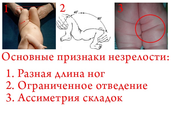 a csípőízület dysplasztikus artrózisa 2 fokkal)
