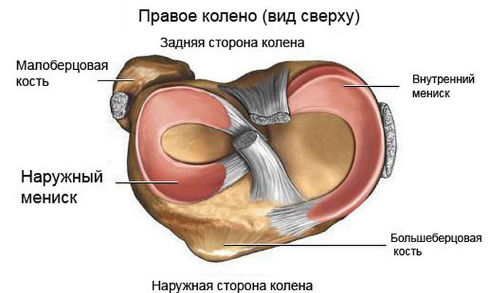 Disecarea osteochondritei genunchiului